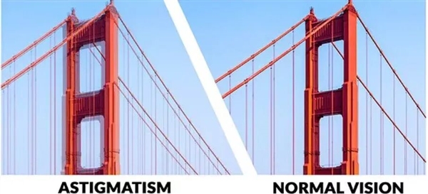 总是模糊重影 看灯会散开：你的眼睛可能出现这问题了