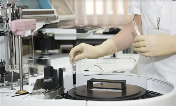 这4种癌症早期筛查真的有用！劝你立马收藏