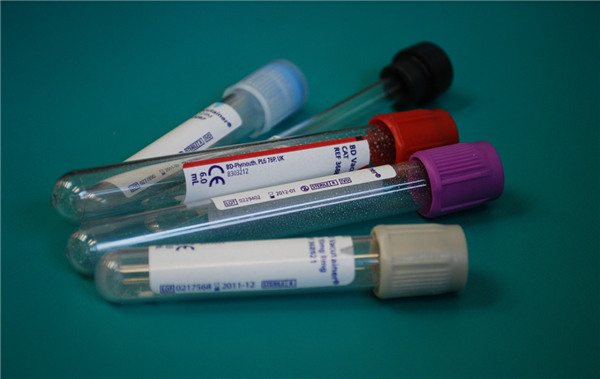 这4种癌症早期筛查真的有用！劝你立马收藏