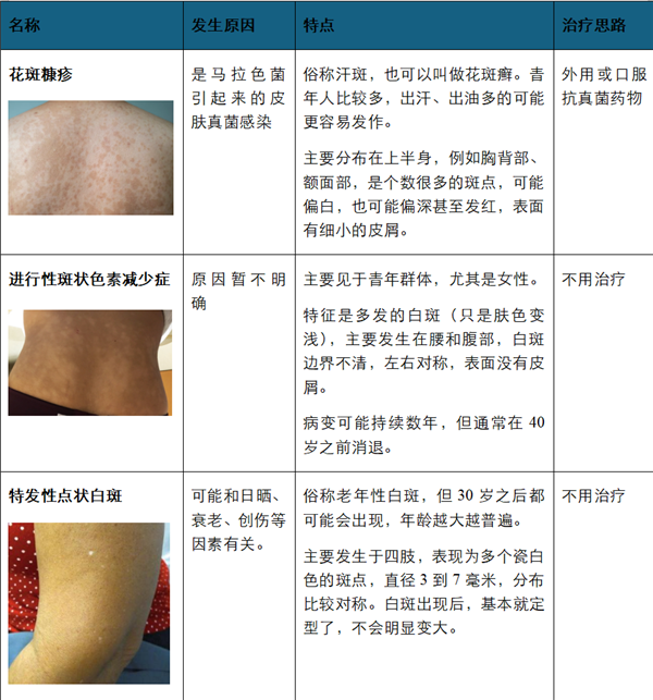 其他成人较为常见的皮肤白斑 表格中图片
