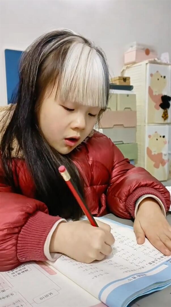 7岁女孩天生白色刘海：确认罕见病