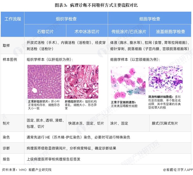 图表3:病理诊断不同取样方式主要流程对比