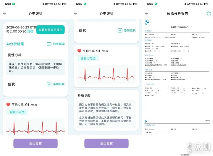 专注心脏健康监测，乐普W20心电手表使用分享_新浪众测