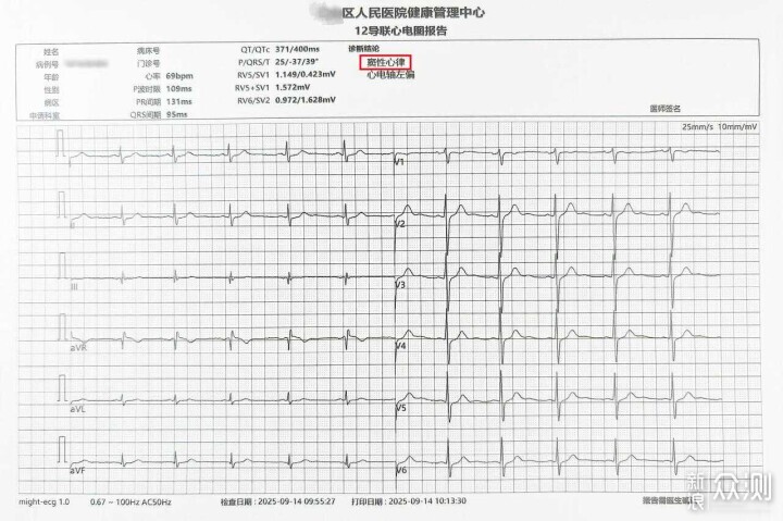 医疗级心电手表,全面监测心脏健康的乐普W20_新浪众测